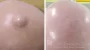  skin lumps and bumps